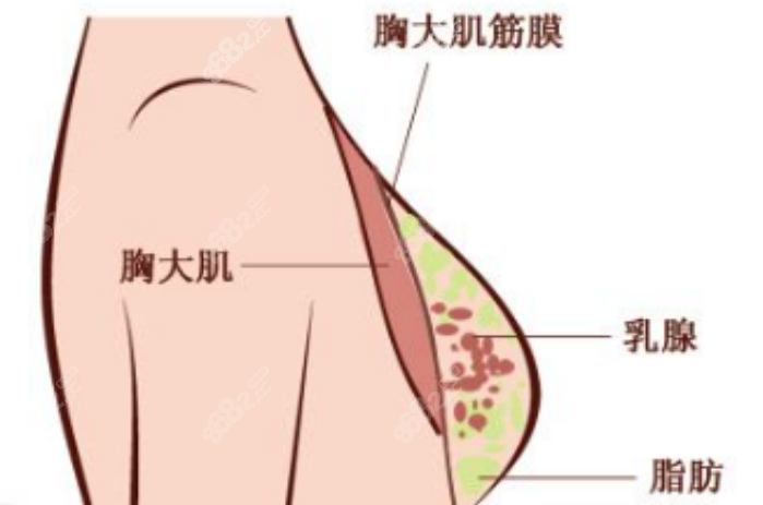 斯良洪医生隆胸