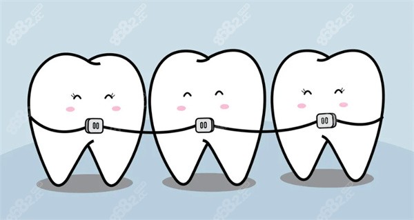 石家庄长安区正规牙科牙齿矫正价格多少