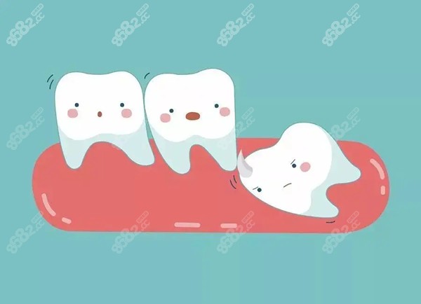秦皇岛拔牙可以报销吗