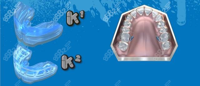 MRC早期干预矫正牙套——K系列