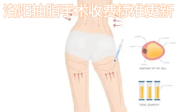 洛阳抽脂收费标准更新