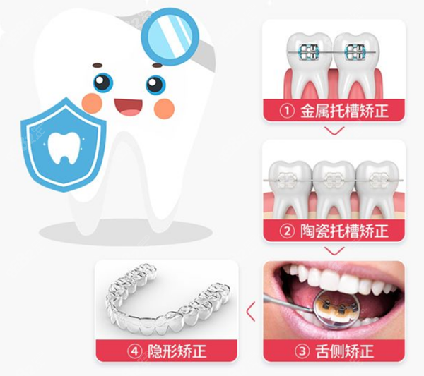 牙齿矫正的几种方式8682.cc