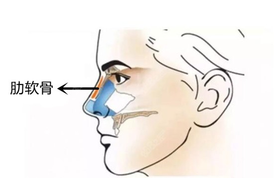 肋軟骨鼻綜合手術示意圖