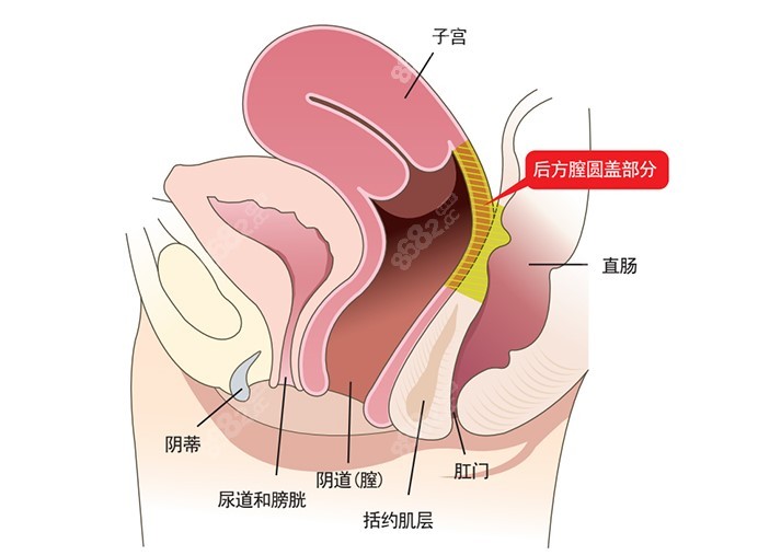 韩国好手艺整形医院做女性私密紧缩术技术优势8682.cc