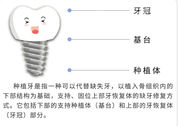 佛山华美口腔种植好