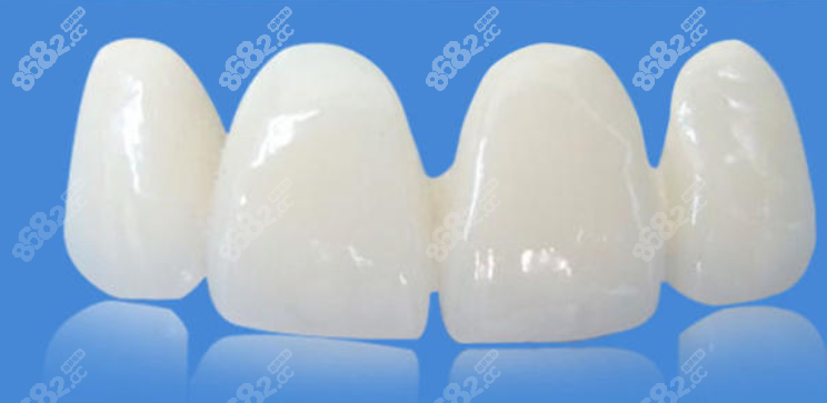<!--<i data=20240705-sp></i>-->口腔全瓷牙价格