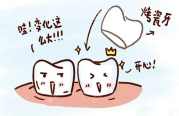 烤瓷牙佩戴m.8682.cc