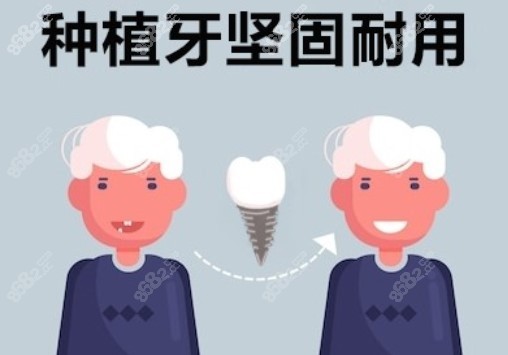 广州德伦口腔全口种植牙技术优势
