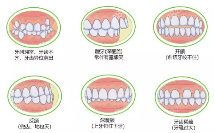 华美牙科正畸收费标准公布（m.8682.cc）