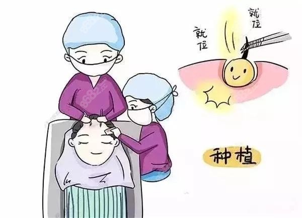 科学植发一植即发(我想植发,谁能给普及一下植发的知识?)