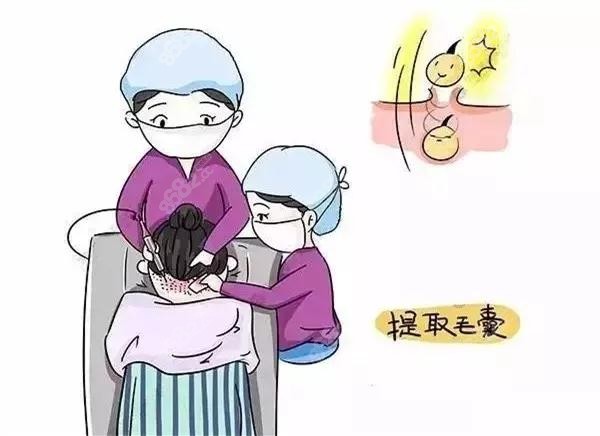 植发是怎么取毛囊的