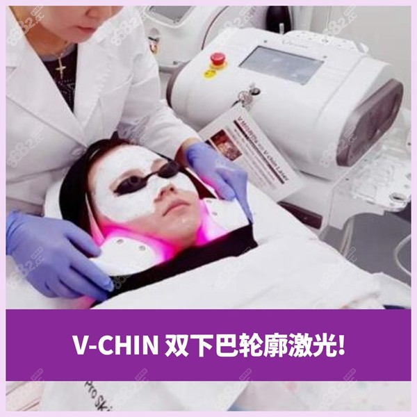 V-Chin双下巴轮廓激光治疗过程
