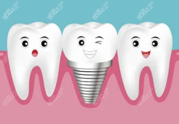 种植牙口腔医生免费咨询在线问诊