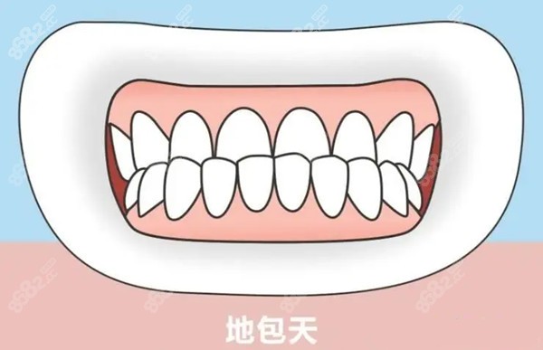 矫正牙齿期间是可以拔牙的