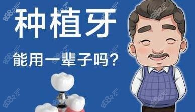 邵东邵阳口腔和雅贝康口腔做种植牙技术好