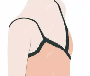 平胸手术价格多少钱？贵吗？（8682.cc）