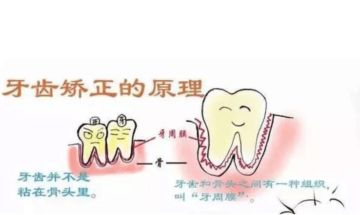 牙齿矫正的原理www.8682.cc