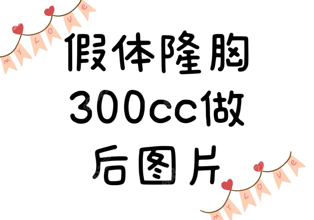 假体隆胸300cc做后图片