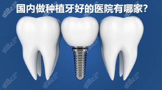 国内做种植牙好的医院有哪家
