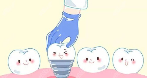小县城种植牙多少钱一颗2025价格表