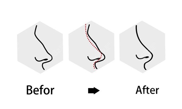 南京有名的修复鼻子的医生有哪些www.8682.cc