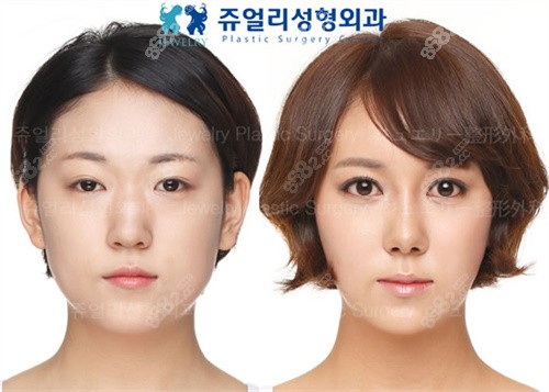 韩国珠儿丽整形外科