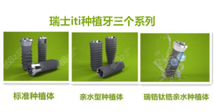 蚌埠皖美口腔种植牙价格