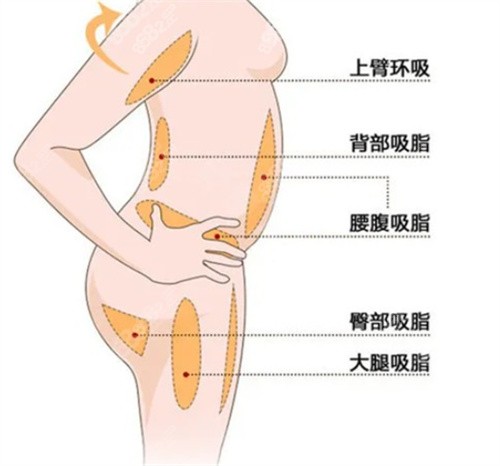 王志军吸脂技术怎么样？