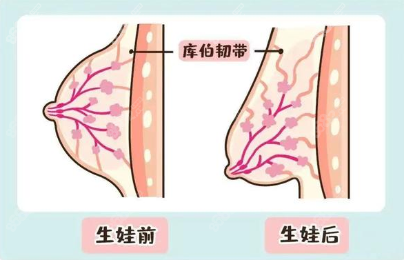 缩胸手术费用8682.cc