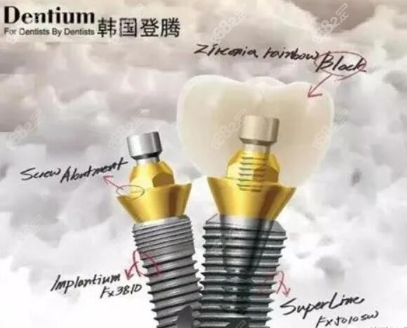 种植牙性价比高的登腾种植体