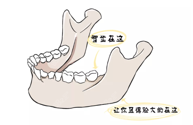 韩国做轮廓三件套多少钱