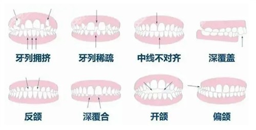 成都新桥口腔牙齿矫正技术精良