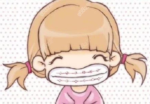 牙齿矫正漫画
