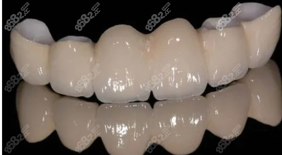 蚌埠皖美口腔全瓷牙价格8682.cc