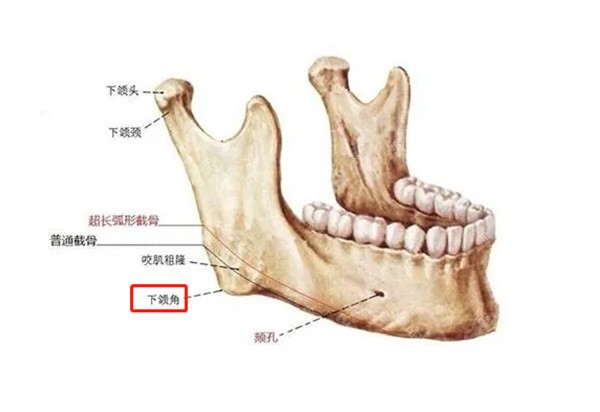 轮廓修复手术费用需要准备多少？