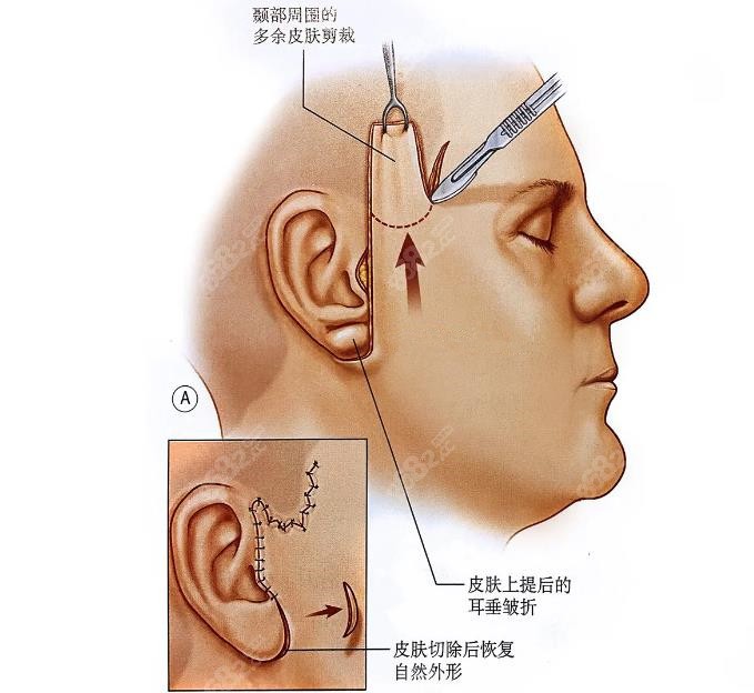 长沙亚韩赵贵庆口碑怎么样