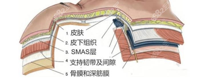 长沙小拉皮手术医生技术优势