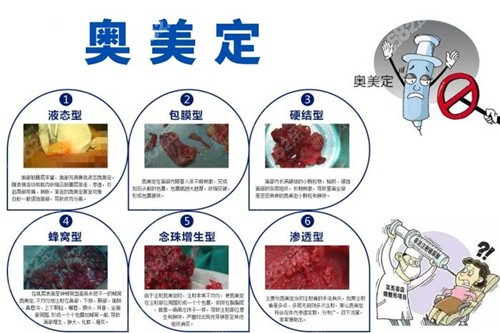 广州取奥美定好的医生名单