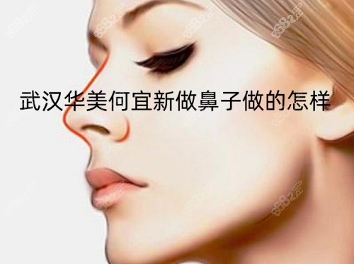 <!--<i data=20240705-sp></i>-->何宜新做鼻子做的怎样