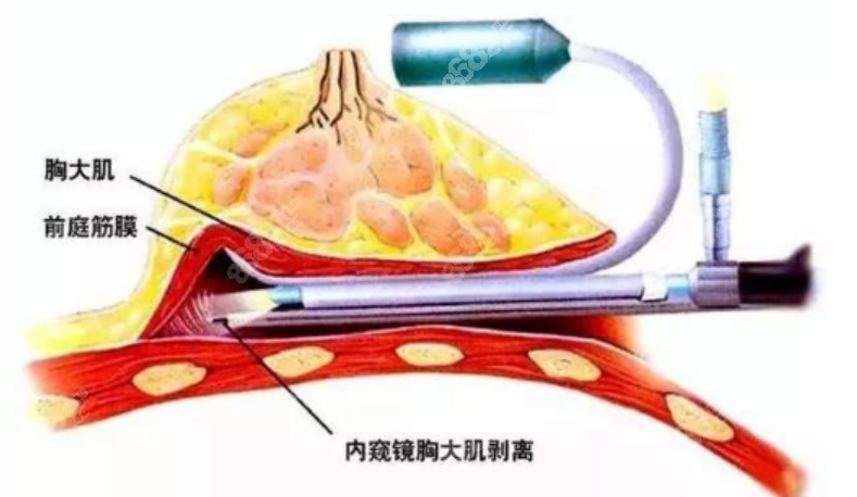 张成春医生在哪个医院坐诊