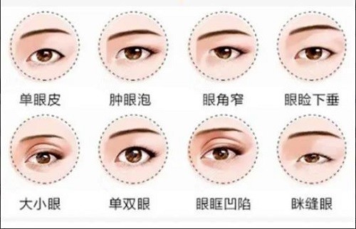 北京双眼皮修复好的医生及价格：