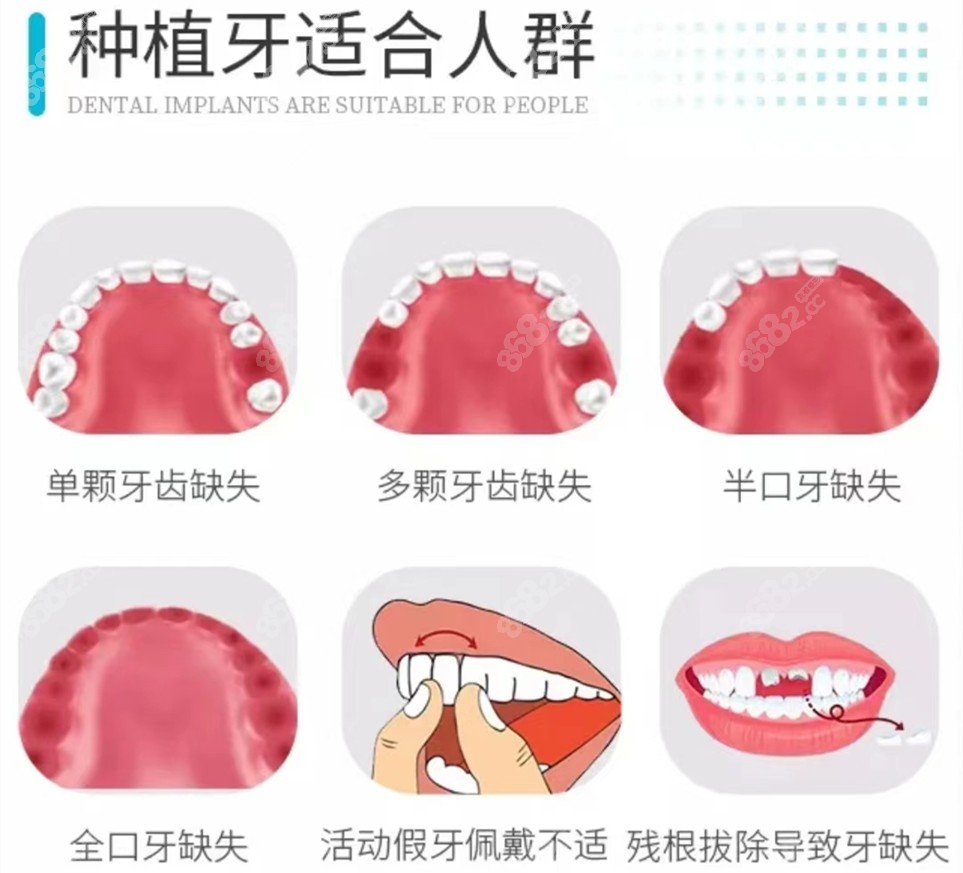 装全口假牙一般能用多少年