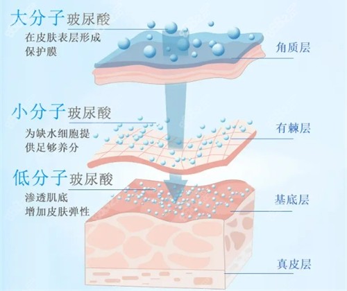 深圳玻尿酸注射医生排名榜