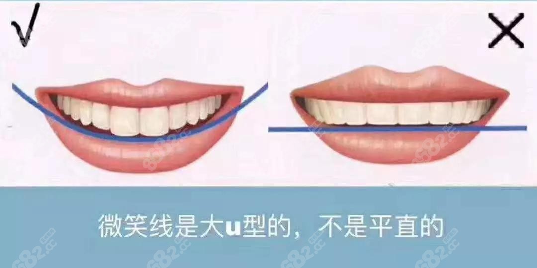 廈門麥芽口腔醫(yī)院瓷貼面技術(shù)