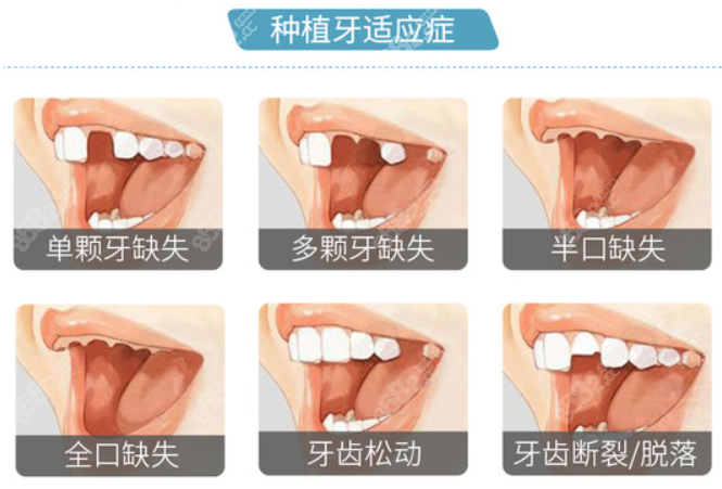 万州京植口腔医院收费高吗m.8682.cc