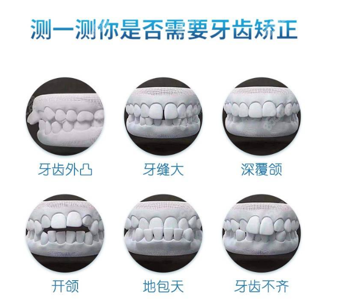 合肥哪家医院整地包天牙齿比较好