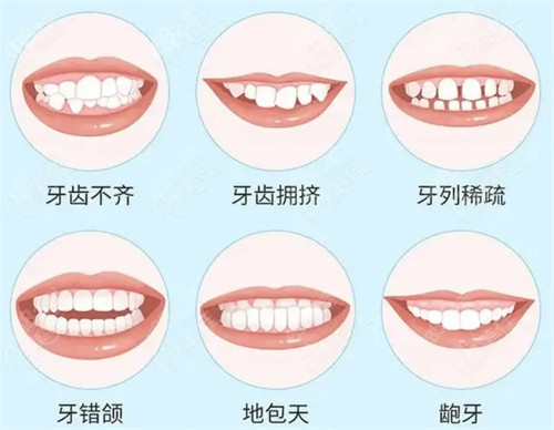 珠海仁爱口腔数字化矫正技术高超