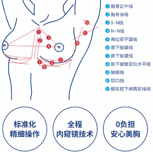 深圳富华唐新辉隆胸优势介绍