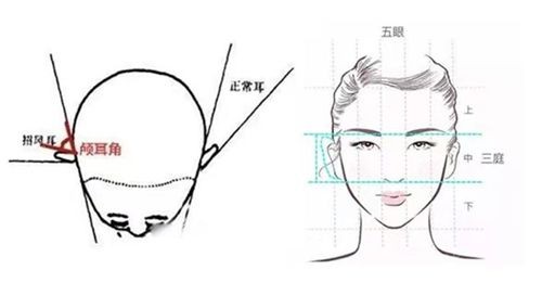 玻尿酸填充耳基底热门问题汇总.jpg