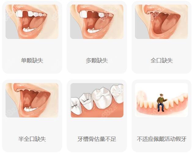 无锡种植牙医院排行榜前十名更新www.8682.cc